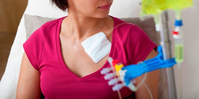 beneficios-de-tener-un-implantofix-o-cat-ter-para-quimioterapia